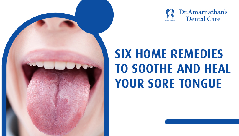 6 Home remedies to soothe and heal your sore tongue