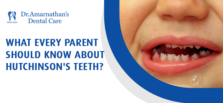 What every parent should know about Hutchinson's teeth ?