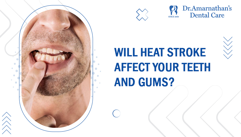 Will heatstroke affect your teeth and gums?