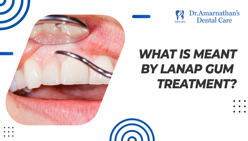 What is meant by LANAP gum treatment?