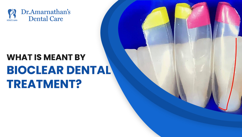 What is meant by bioclear dental treatment?