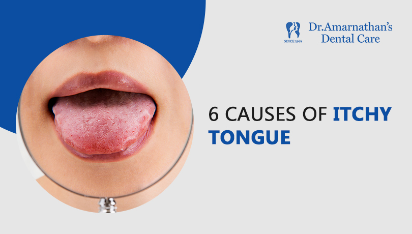 6 causes of itchy tongue