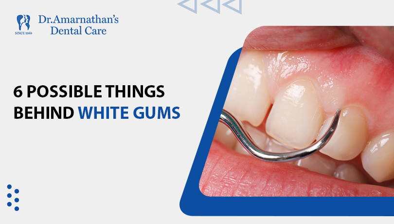 6 possible things behind white gums