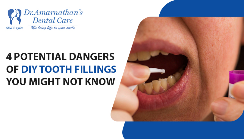 4 potential dangers of DIY tooth fillings you might not know