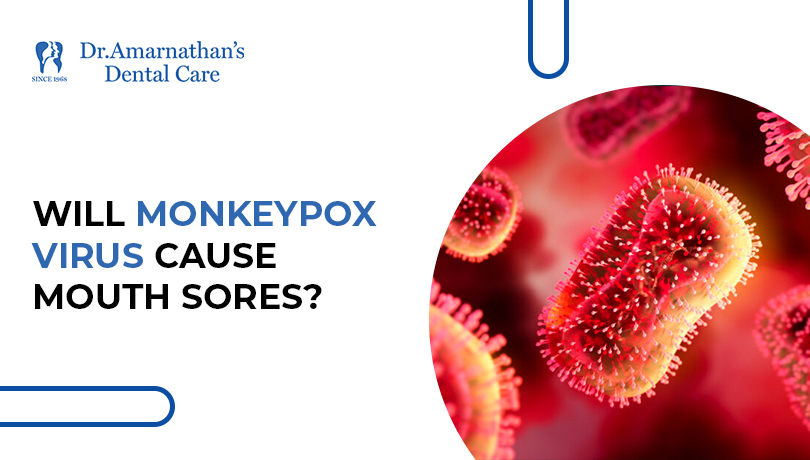 Will monkeypox virus cause mouth sores?