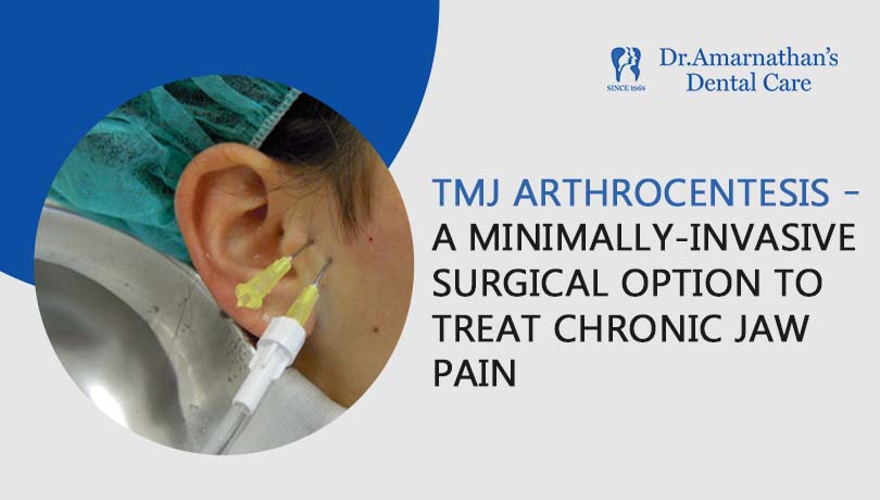 TMJ Arthrocentesis – A minimally-invasive surgical option to treat chronic jaw pain