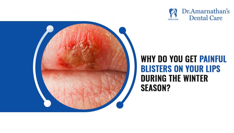 Why do you get painful blisters on your lips during the winter season?