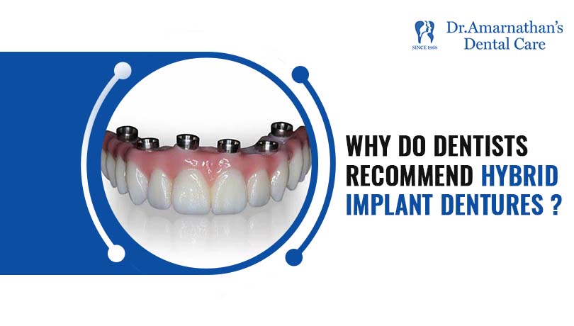Why do dentists recommend hybrid implant dentures?