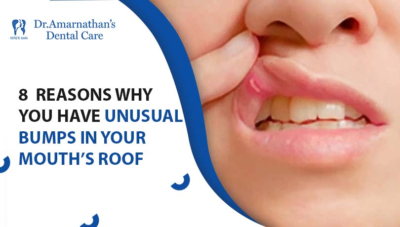 8 reasons why you have unusual bumps in your mouth’s roof