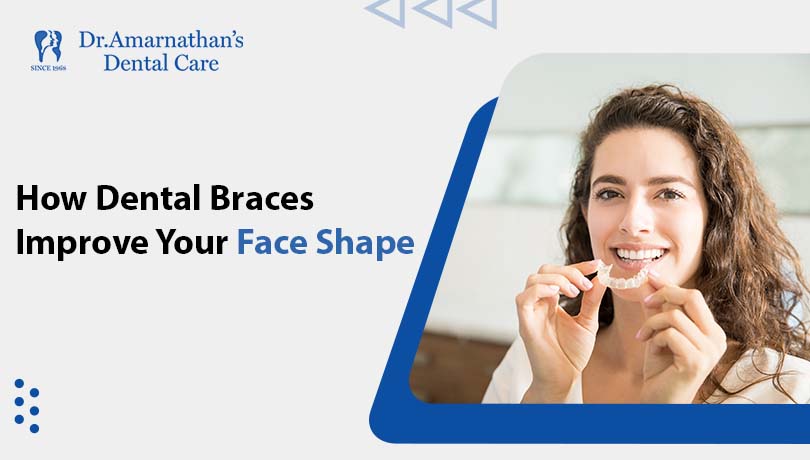 How Dental Braces Improve Your Face Shape