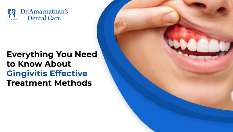 Everything You Need to Know About Gingivitis Effective Treatment Methods