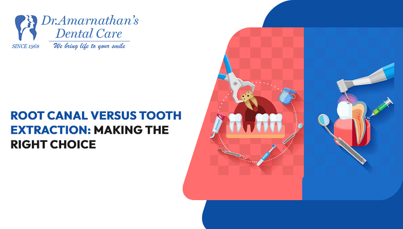 Root Canal versus Tooth Extraction: Making the Right Choice